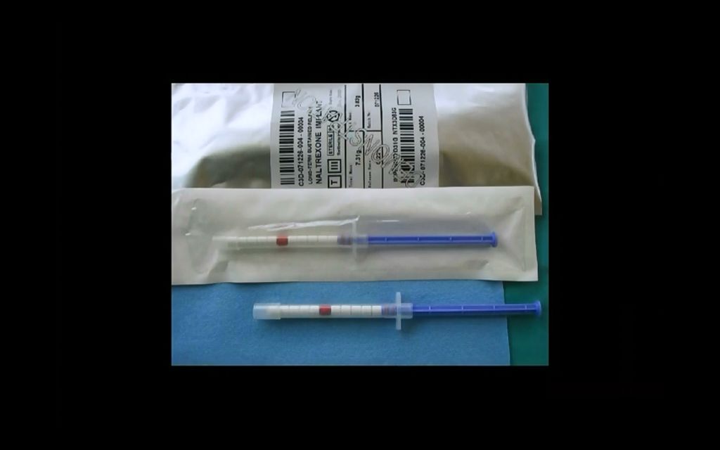Naltrexone implant syringe